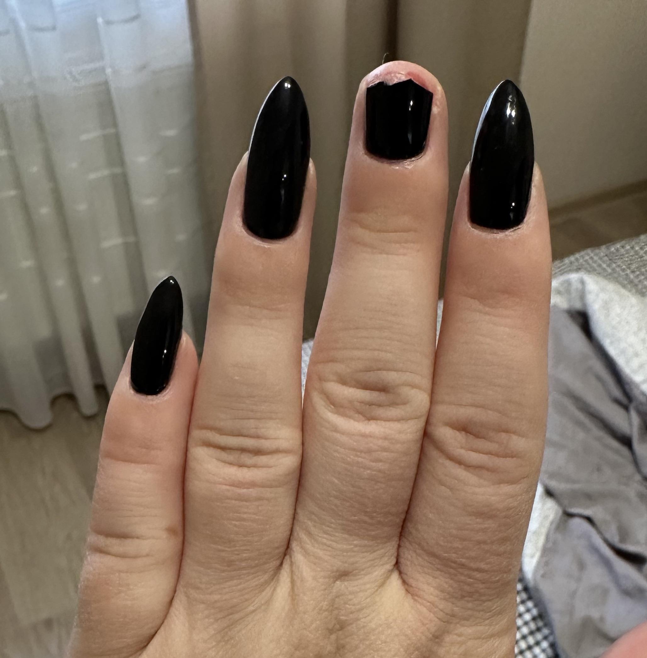 Help?! How soon can I go to nail salon and fix it?