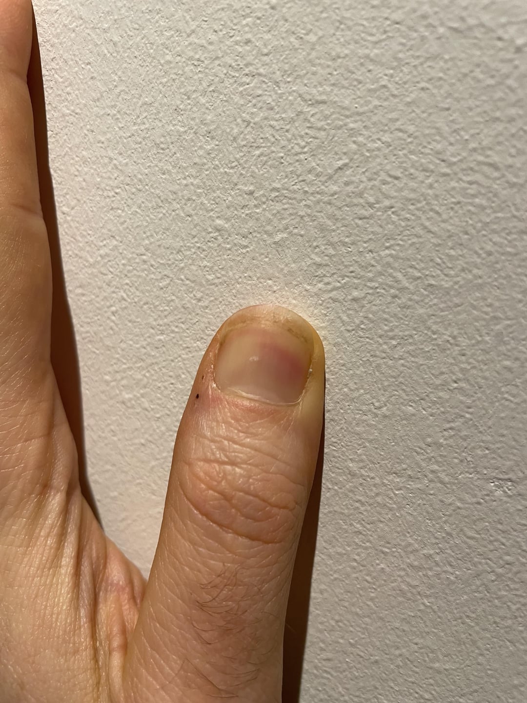 Just started using nail polish, my nails health is degrading fast. Help